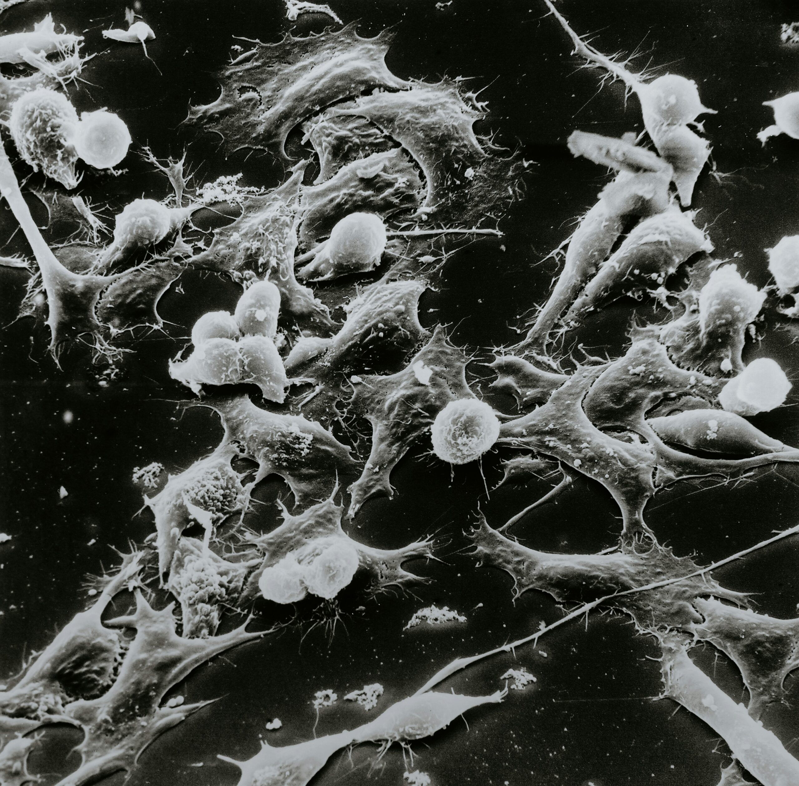 The Truth About Turbo Cancers